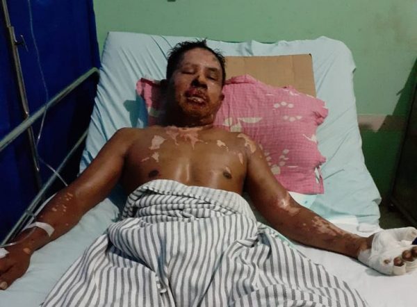 Proyek Jalan Adiluwih Makan Korban, Pengguna Jalan Tersiram Aspal?