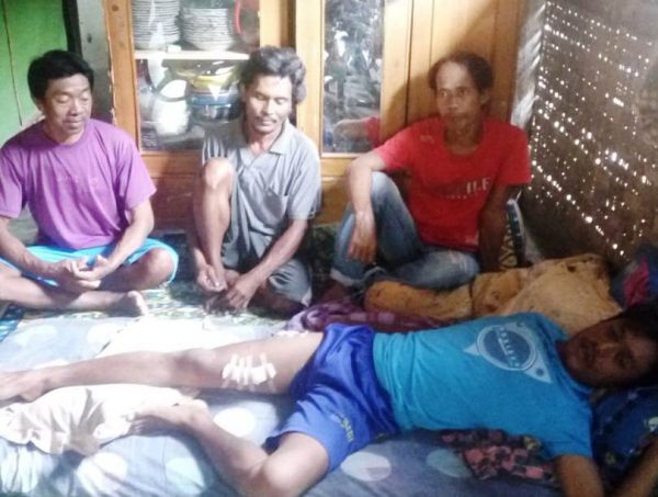 Lagi Buaya Muara Way Semaka Gigit Nelayan Dengan 11 Luka