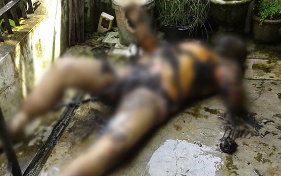 Saiful Azhar Nekat Bakar Tubuh Sendiri Lantaran Stres Sang Istri Yang Sakit Tak Kunjung Sembuh