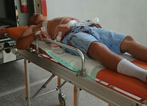 Warga Talang Padang Korban Penusukan Saat Pilkades di Pesawaran Wafat