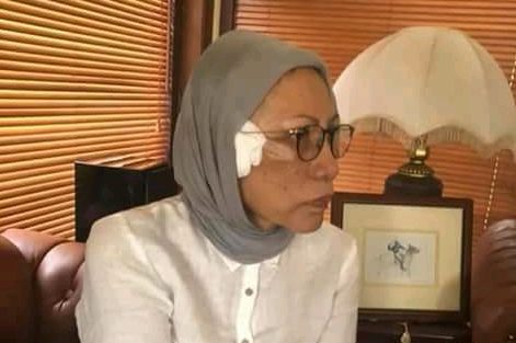 Ratna Sarumpaet Dikabarkan Trauma Pasca Penganiayaan