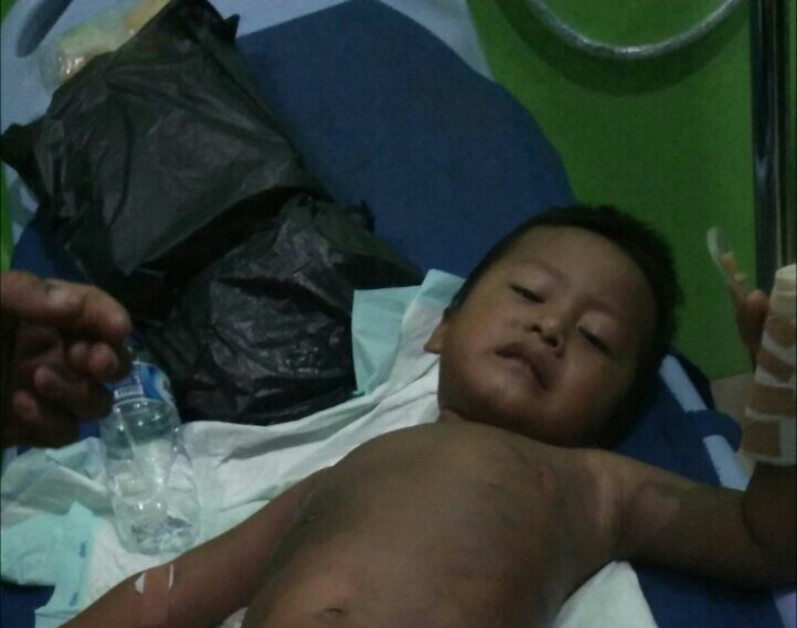 Asyik Bermain Bocah Empat Tahun Tersiram Air Panas