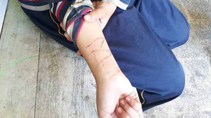 BNNP Lampung : Aksi Sayat Tangan Bukan Terpengaruh Minuman, Tetapi Sebuah Tantangan