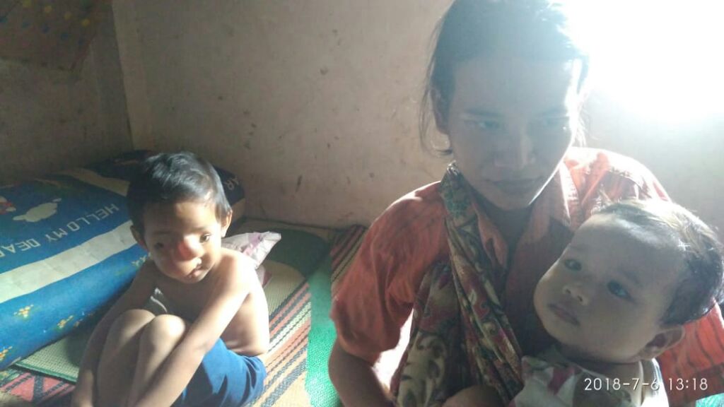 Bocah 6 Tahun yang Menderita Kelenjar Getah Bening di Tubaba Butuh Bantuan