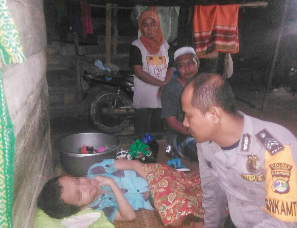 Polres Bersama Dinkes Tubaba dan RSUD Menggala Lakukan Bakti Kesehatan Penderita Hydrocephalus