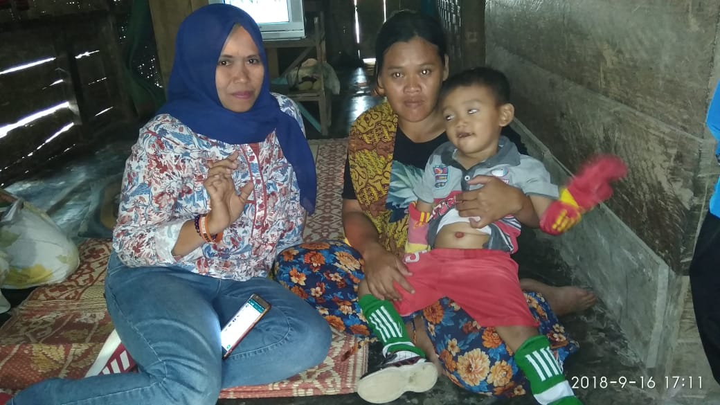 Aji Wijaya, Balita Mengalami Kelainan di Pusar Sejak Lahir Yang Butuh Uluran Tangan di Katibung