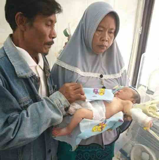 Lahir Tanpa Anus, Bayi di Lamsel Butuh Uluran Tangan