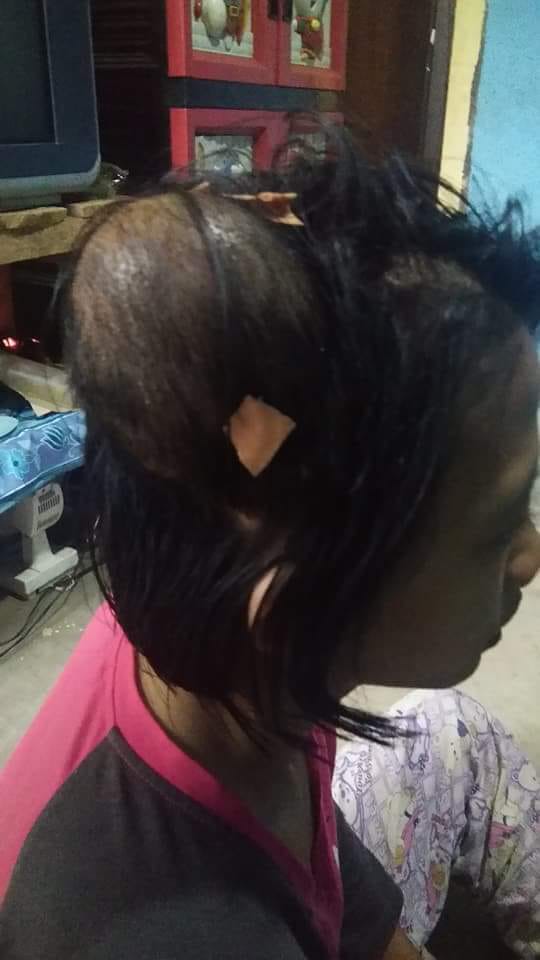 Ibu Pengidap Glioblastoma Multiforme Butuh Bantuan Dermawan