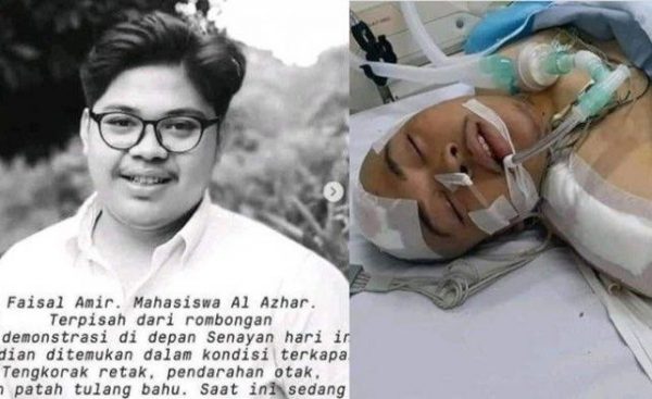 Korlab Aksi di DPR Asal Mahasiswa Al-Azhar Faizal Amir Masih Kritis di ICU RS Pelni