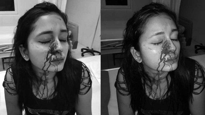 Lebih Cantik dan Glamor Nita Dipukuli Hingga Babak Belur oleh Temannya