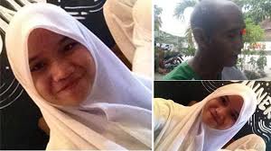 Polisi Harus Usut Kematian Mahasiswi UBL Cantik Retina Ratri