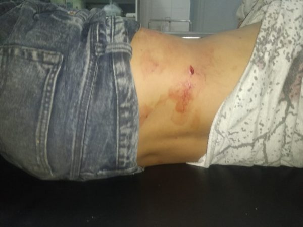 Keponakan dan Tantenya Tikam Muis di Warnet Aksel