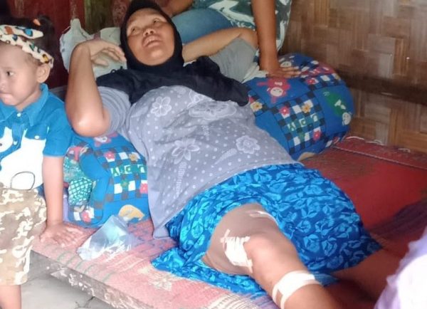 Setelah Suwarni, Kini Mulyani Jadi Korban Serangan Buaya Sungai Way Semaka di Banjarsari