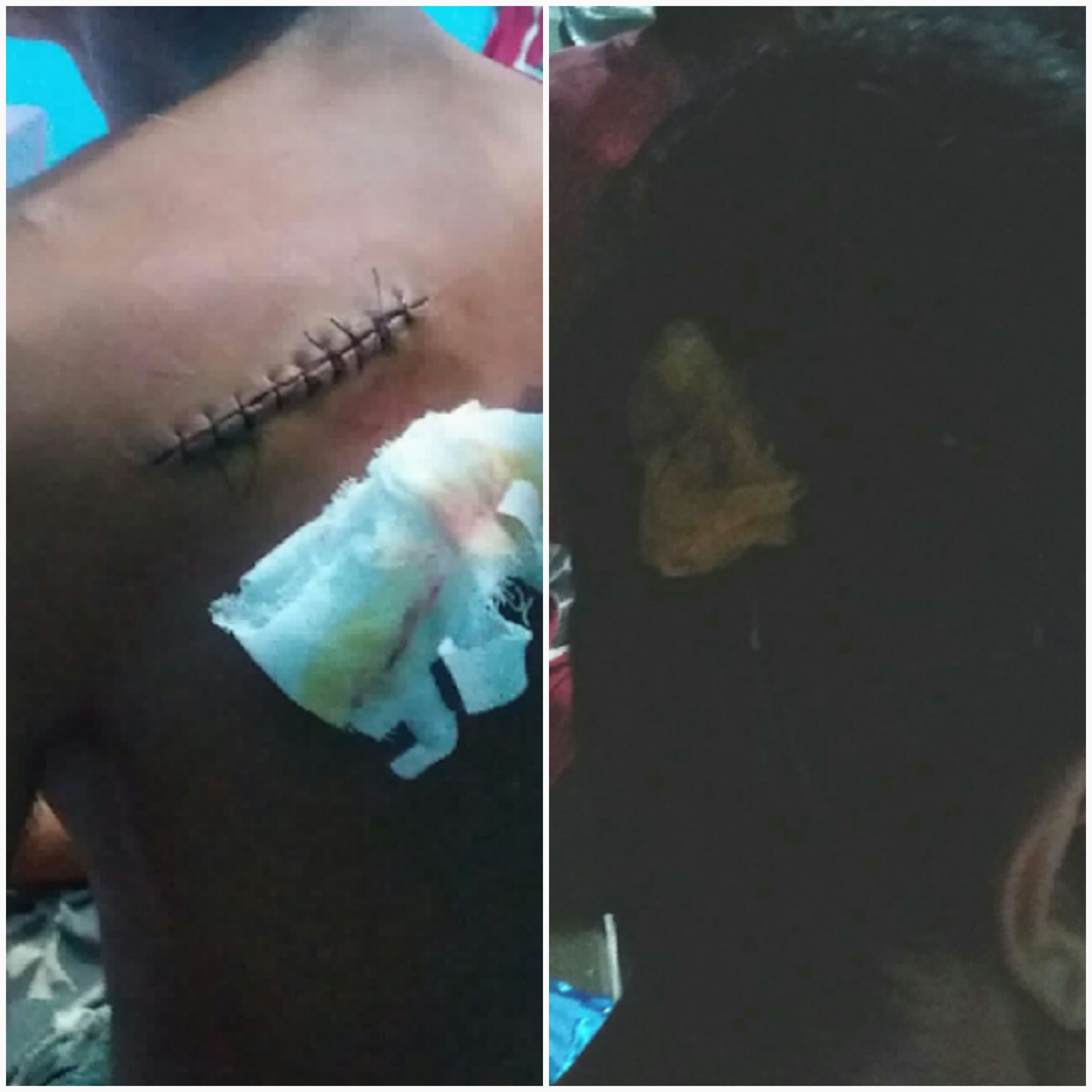 Dapat Info dari Dukun, Kades Labuhan Ratu Kampung Pukul dan Bacok Warganya Sendiri ?