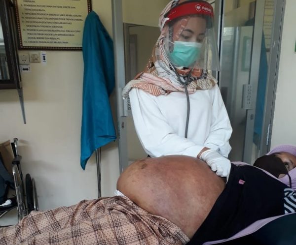 Warga Miskin Penderita Tumor Rahim Sri Harni Asal Wonosobo Tanggamus Butuh Bantuan