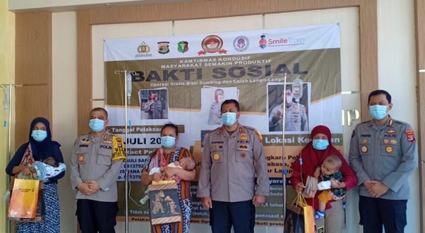 Bakti Kesehatan Polda Lampung Operasi 12 Bayi dan Balita Bibir Sumbing 