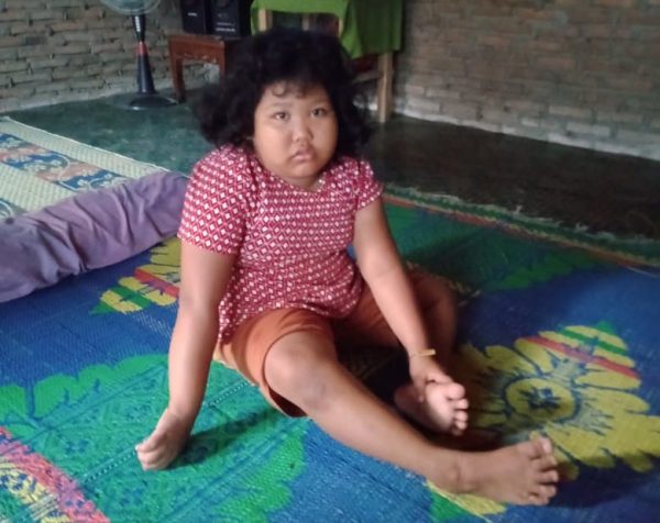 Melinda Sejak Dua Tahun Tak Bisa Berjalan Berangkat Sekolah Digendong Kemiskinan Membuat Tak Pernah Tahu Penyakitnya