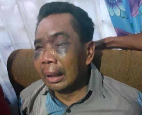 Saksi Dipaksa Jadi Tersangka, Tukang Bangunan Alami Kekerasan Fisik di Polsek Percuk Sei Tuan