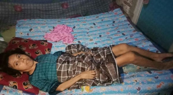 Julaiha Penderita Rheumatoid Arthritis Tiga Tahun Terbaring Butuh Uluran Tangan