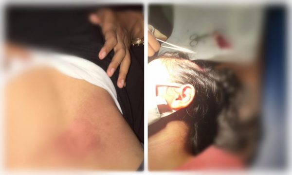 Dua Mahasiswi Kohati HMI Jambi Jadi Korban Kekerasan Aparat Saat Unjuk Rasa Tolak UU Omnibus Law