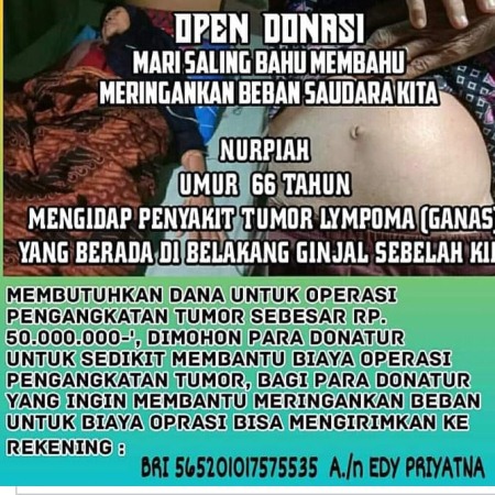 Ayo Bantu Nurpiah Yang Berjuang Melawan Tumor Lympoma
