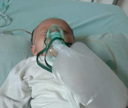 Bayi Berusia Tiga Bulan Di Tanggamus Alami Kelaian Jantung Sejak Lahir