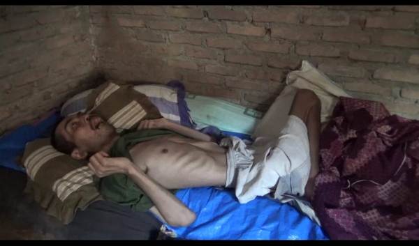 Enam Tahun Derita Epilepsi, Keluarga Daiman Harapkan Bantuan Pemerintah Tanggamus