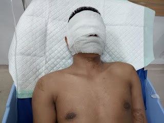 Anak Disiram Air Keras, Ibu Wartawan : Usut Pelaku dan Dalangnya