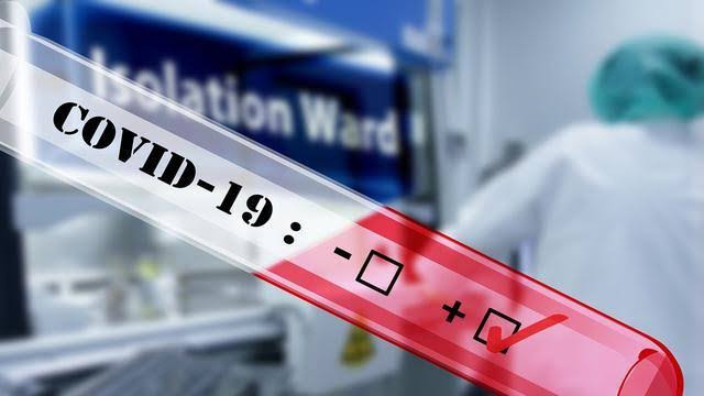 Tiga Bupati Positif Covid-19, Budi Utomo dan Umar Ahmad di RSUDAM, Saply Isolasi Mandiri