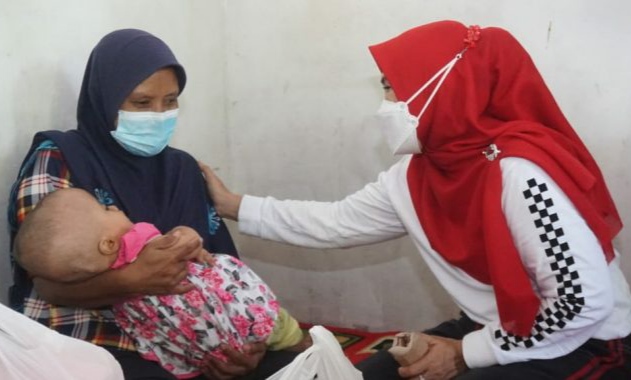 Bunda Winarni Beri Bantuan Balita Penderita Hidrosefalus di Ketapang