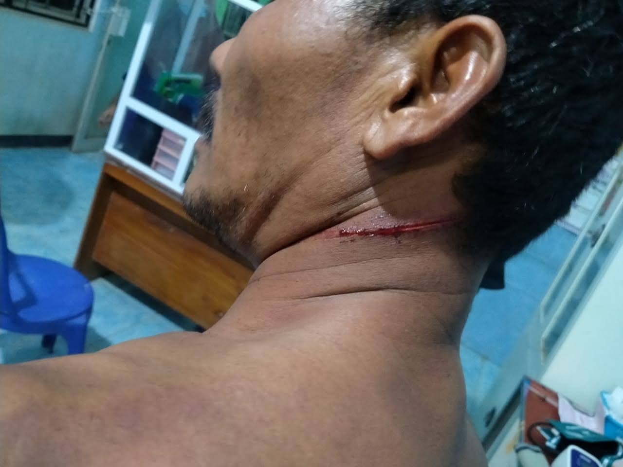 Ketahuan Bercumbu dengan Istri Orang, Oknum RT Kecamatan Mesuji Kena Bacok Suami Sah