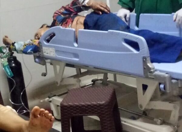 Begal Tebas Ibu dan Anak Motor Honda Beat Dompet dan HP Korban di Bawa Kabur