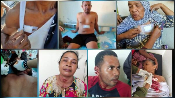 Tangkap Pelaku Pidana di Desa Tamilou Polisi Tembak 18 Warga Masyarakat Maluku Protes