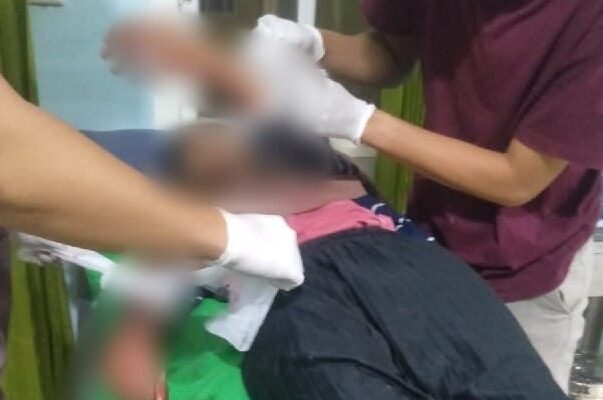 Karyawan Bakso Gangsar Dibegal di Jembatan Ketiaw Terbanggi Tangannya Disabet Golok