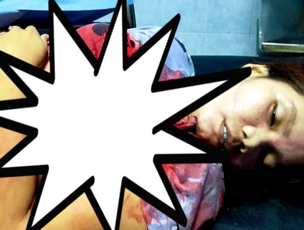 Melda Candimas Tewas Ditikam Seorang Pria Saat Makan Nasi Bungkus Bersama Rekannya