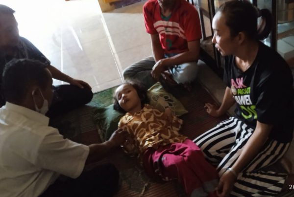 Sindir Pemkab Tanggamus, Penderita Hidrosefalus Anggun Delva Butuh Kursi Roda