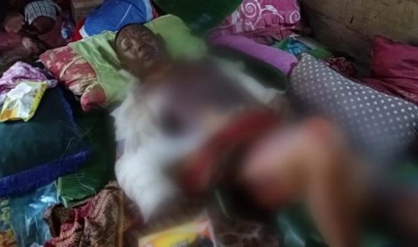 Dua Minggu Dirawat Korban Kebakaran Kontrakan di Tanggerang Wafat di Bandar Lampung