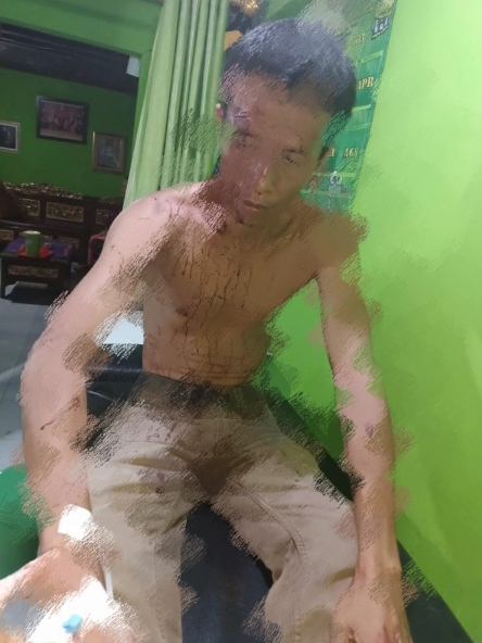 Saksi Sengketa Tanah Kena Tikam