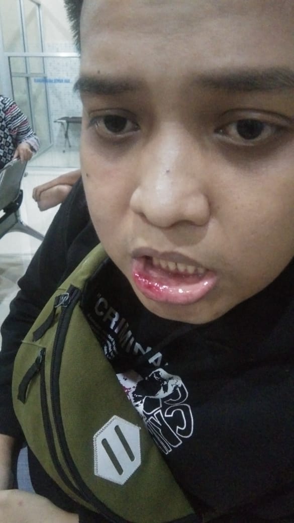 Berawal Cekcok Warga Lampura Menjadi Korban Pengeroyokan