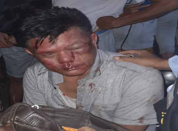 Tabrak Motor Beat Pake Pajero Lalu Kabur Jaksa Babak Belur Dikroyok Warga