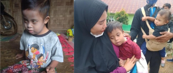 Mengidap Downsyndrome dan Katarak Fahri Membutuhkan Biaya Operasi dan Terapi