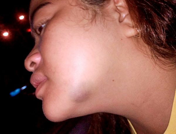 Seorang Wanita dan Sepupunya Diculik Lalu Disekap dan Dianiaya di Kuburan China Natar