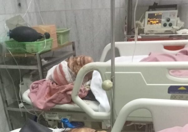 Lambat Dioperasi Satu Korban Pembacokan Orang Gila di Bandar Lampung itu Tewas