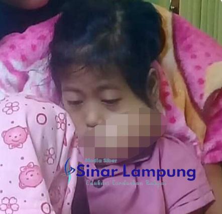 Ananda Zihan Penderita Tumor Mandi Gula Membutuhkan Bantuan Pengobatan