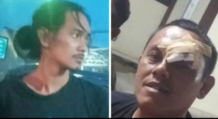 Dua Wartawan Dianiaya dan Dipaksa Minum Air Seni oleh Oknum Kepala Dinas di Pemkab Karawang