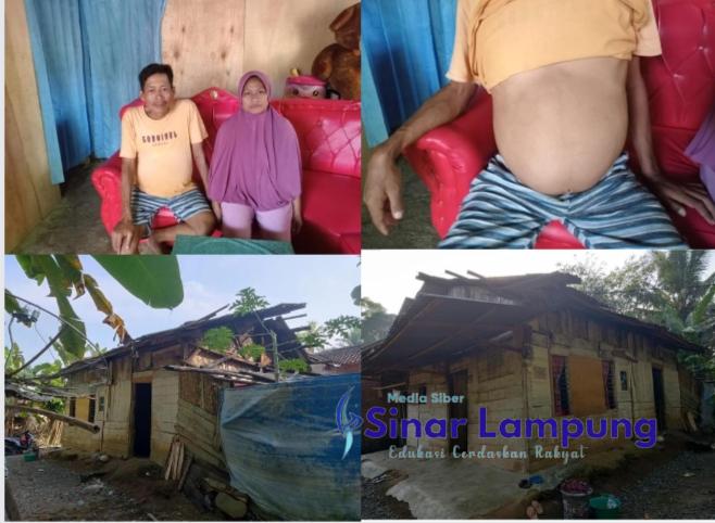 Sugiyanto  Penderita Leukimia Butuh Perhatian Bupati dan Uluran Tangan Para Dermawan