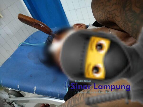 Pria Bersimbah Darah di Jalan Yossudarso Sukaraja Dengan Pisau Menancap di Kening Akhirnya Tewas