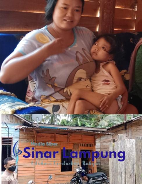 Bocah Penderita Epilepsi di Pekon Banyurip, Kecamatan Wonosobo,, Harapkan Perhatian Pemerintah dan Uluran Tangan Dermawan