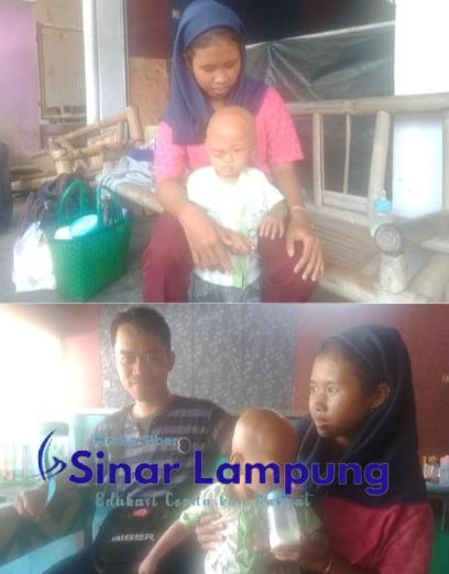 Balita Penderita Retinoblastoma Butuh Bupati Tanggamus