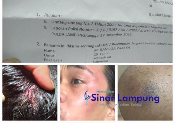 Korban Penganiayaan Petugas PLN di Rawat Sementara Humas PLN Sebut Pegawainya Yang Dikeroyok?